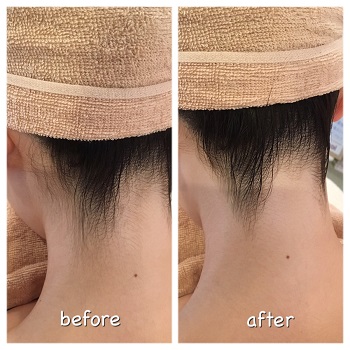 女性シェービングのエステikoi。うなじ